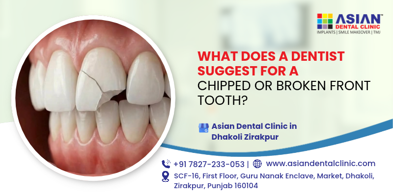 What Does A Dentist Suggest For A Chipped Or Broken Front Tooth ?