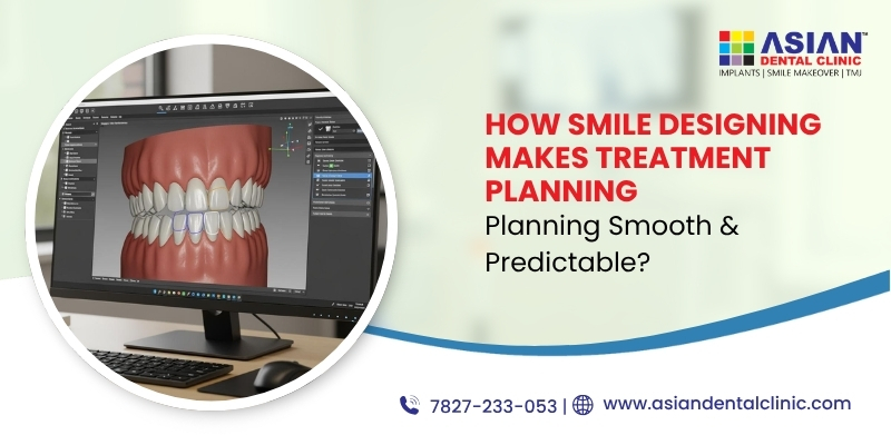 How Smile Designing Makes Treatment Planning Smooth and Predictable?