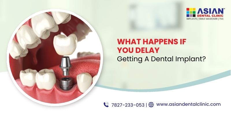 What Happens If You Delay Getting a Dental Implant?