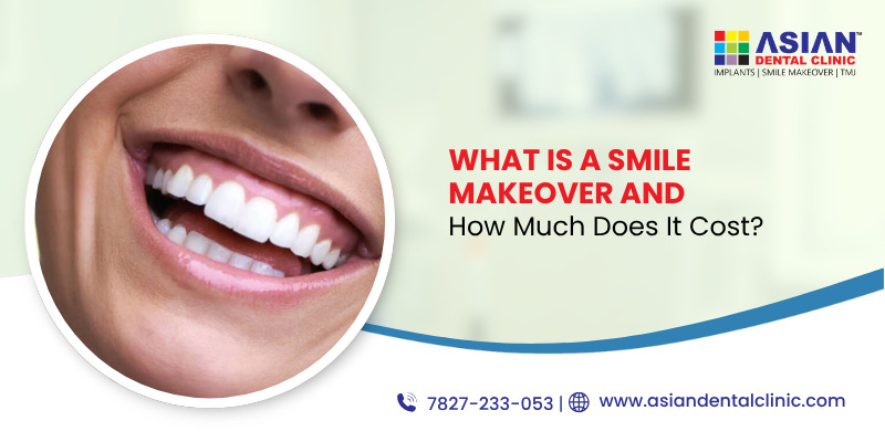 What Is a Smile Makeover and How Much Does It Cost?